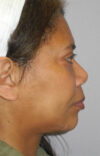 Neck Tuck case #6948